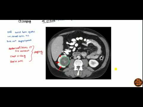 Renal Cell Carcinoma for USMLE