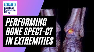 Nuclear Medicine | SPECT-CT | Extremities