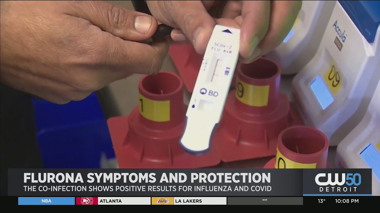 Flurona Symptoms And Protections