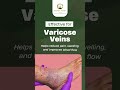 Experience the power of Leech Therapy