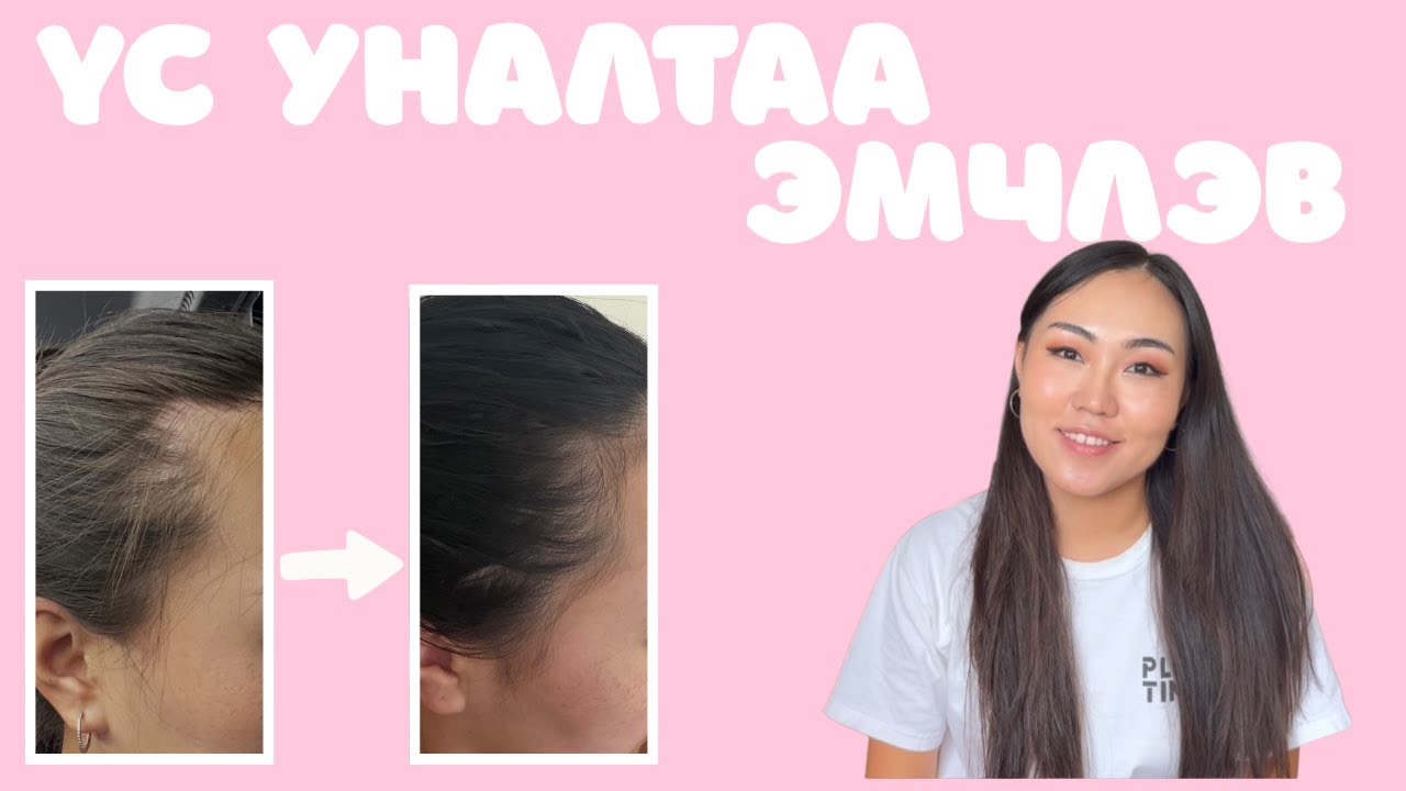 Үс уналттай тэмцсэн 7 жил | Хамгийн сайн бүтээгдэхүүнүүд