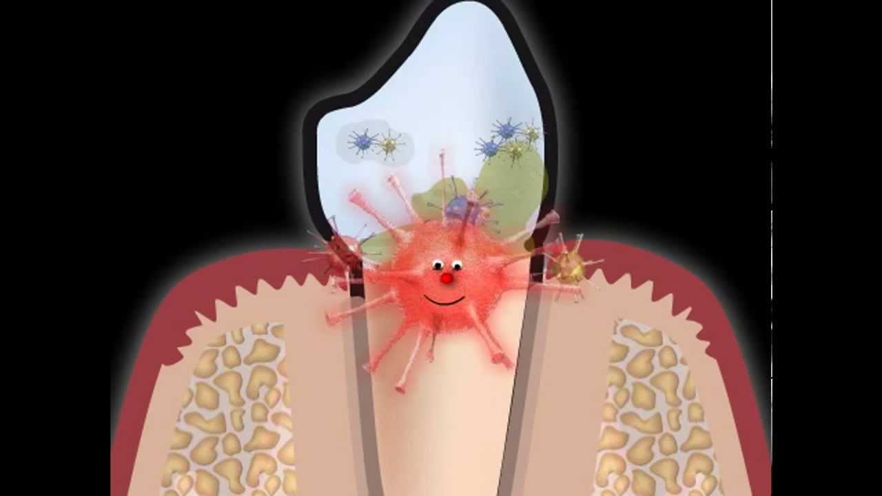 Waterpik - Irrigatore orale