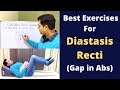 Exercises For Diastasis Recti, Abdominal Seperation, Diastasis Recti Treatment- Reason of Back Pain