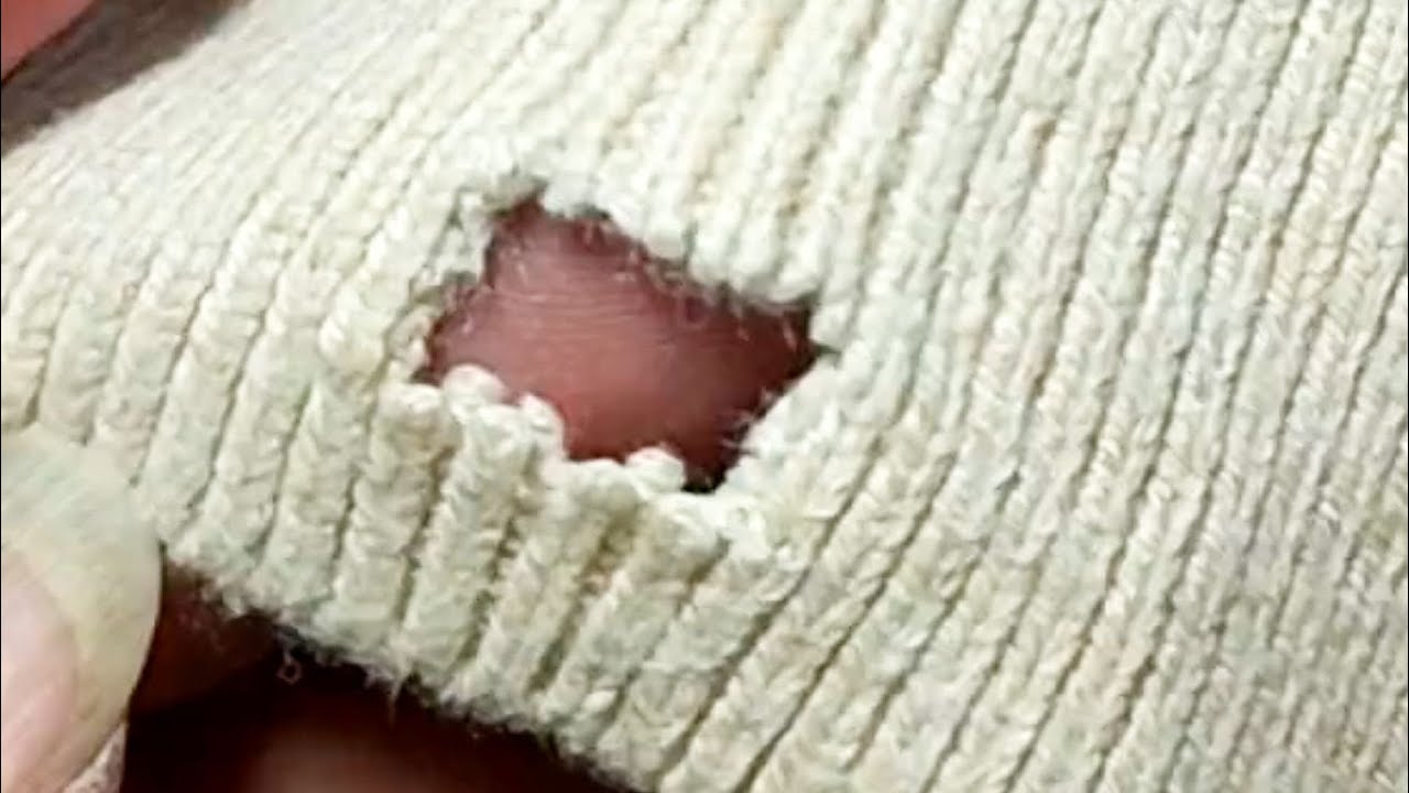 How to Perfectly Repair Holes in a Knitted Sweater Without Leaving any ...