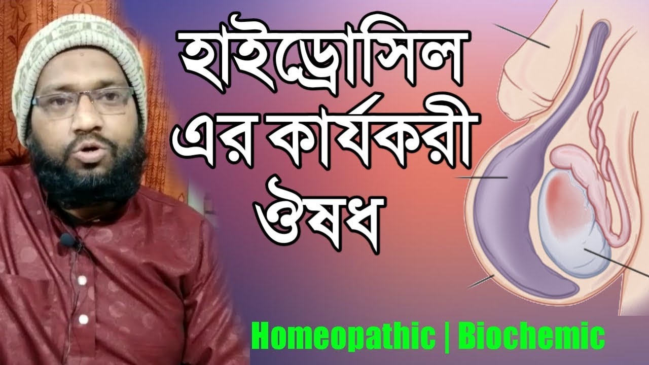 হাইড্রোসিল এর হোমিওপ্যাথি চিকিৎসা | hydrocele treatment in homeopathy in bangla