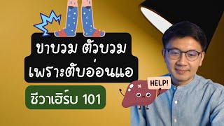 ขาบวม ตัวบวม เพราะ ตับอ่อนแอ ใช้สมุนไพรอะไรดี ? - ชีวาเฮิร์บ 101