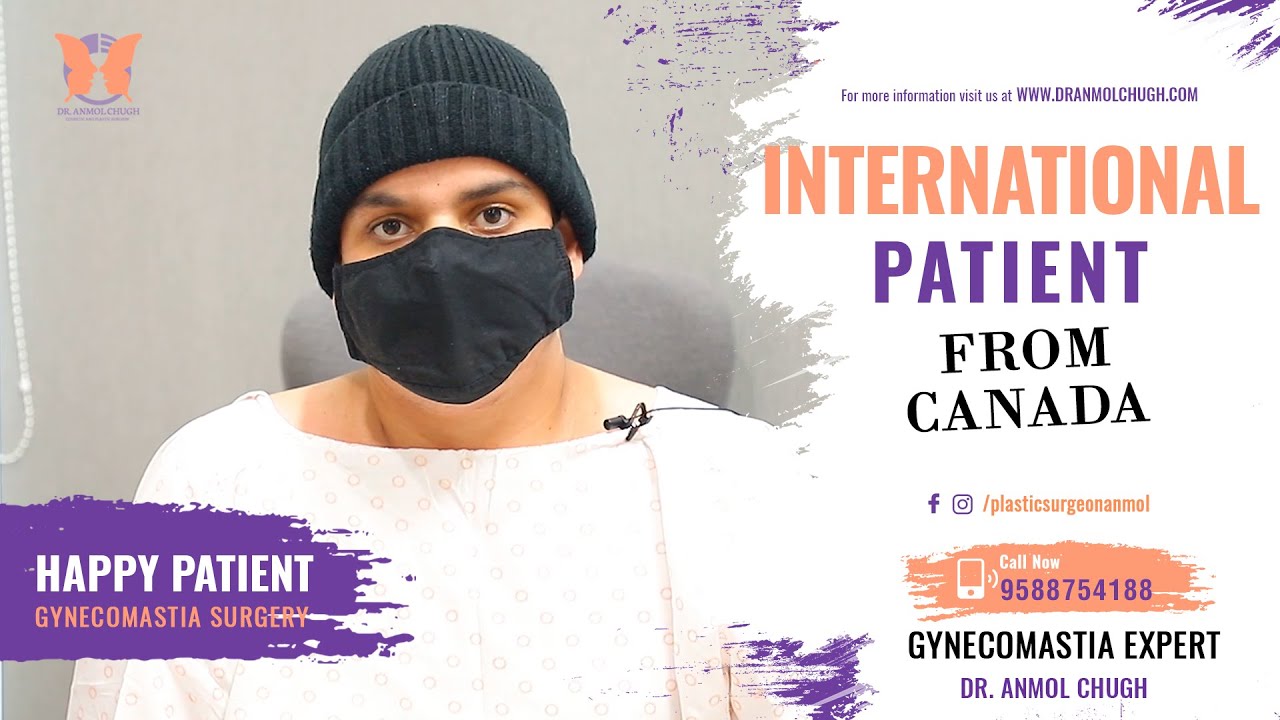 Happy International Patient From Canada For Gynecomastia Surgery : Man Chest Reduction Surgery India