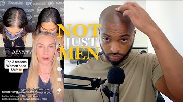 Women Are Getting Scalp Micropigmentation Too (Reaction) #Get2Steppin