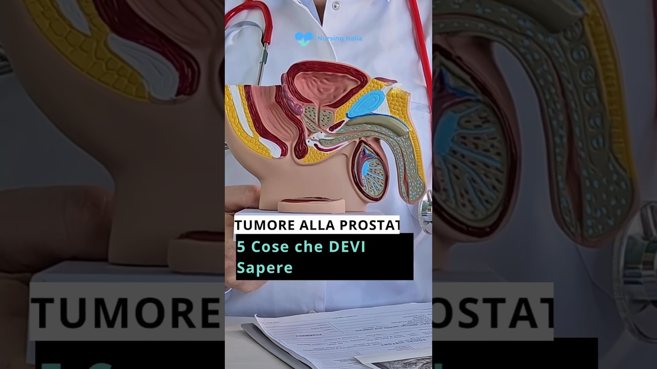Tumore alla prostata: 5 cose che ogni uomo dovrebbe sapere.