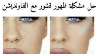 حل مشكله ظهور القشور عند استعمالك للفاونديشن