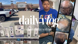 VLOG| Can you cure Alopecia?! + Unexpected Hairstylist Issues &amp; being a Mom