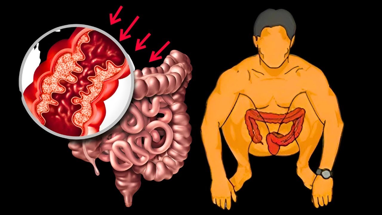 1 Cup Before Bed All the Dirt Will Come Out 🔥 Colon Cleansing fast ...