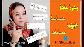 أحسن و أفضل علاج للبشرة الحساسة  غاسول الوجه،كريم للترطيب و واقي شمسي.سوف تتخلصين من حساسية البشرة?