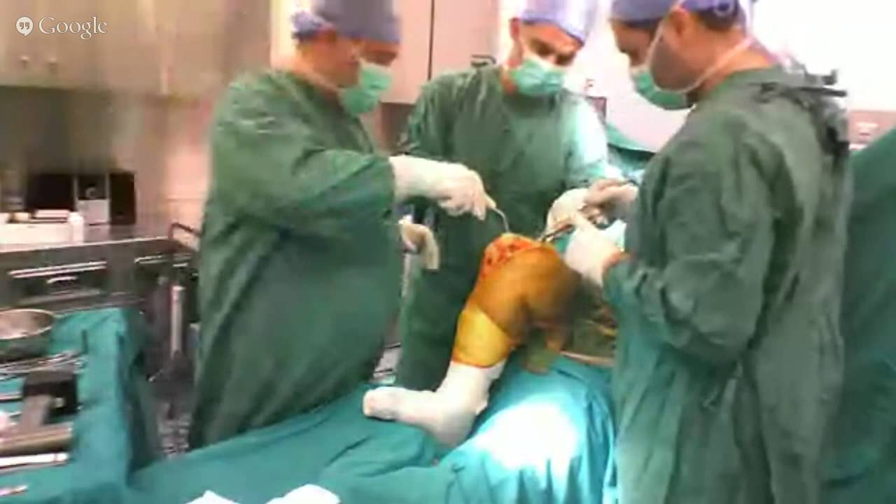 live total knee replacement personalized knee system by dr gakis athens