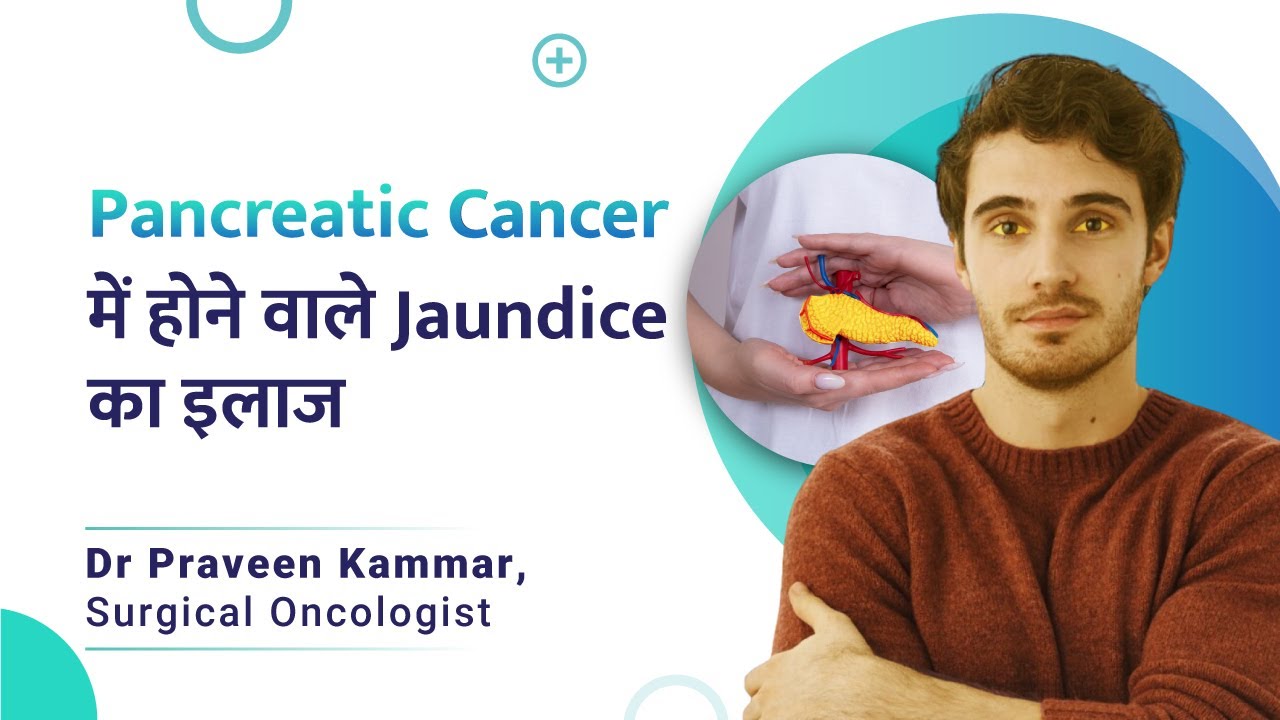 Treatment for pancreatic cancerrelated jaundice pancreatic cancer