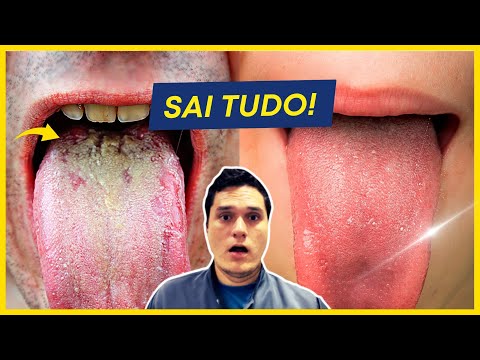 Vídeo: 3 maneiras de ter uma língua saudável