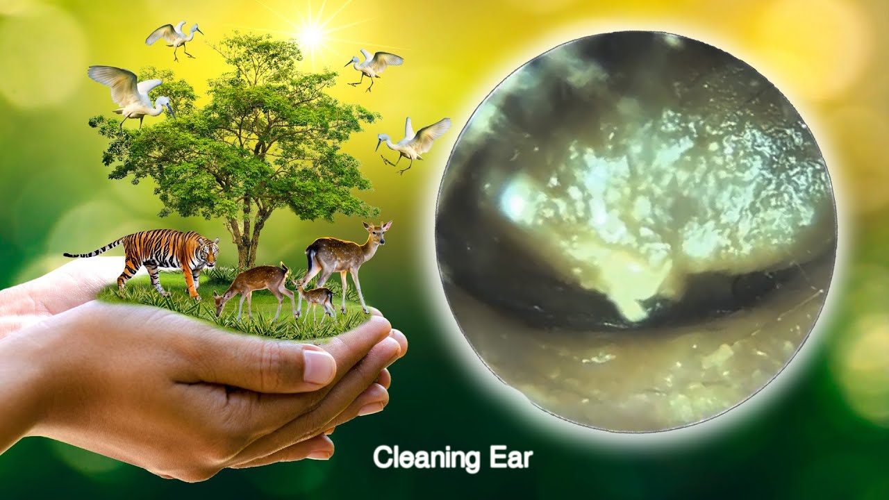 グリップイヤーワックス除去 grip ear wax removal part 137 YouTube