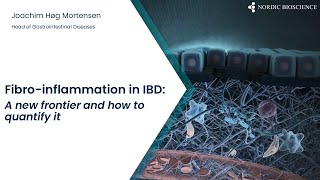 Webinar | Serum Calprotectin and Mucosal Damage in IBD