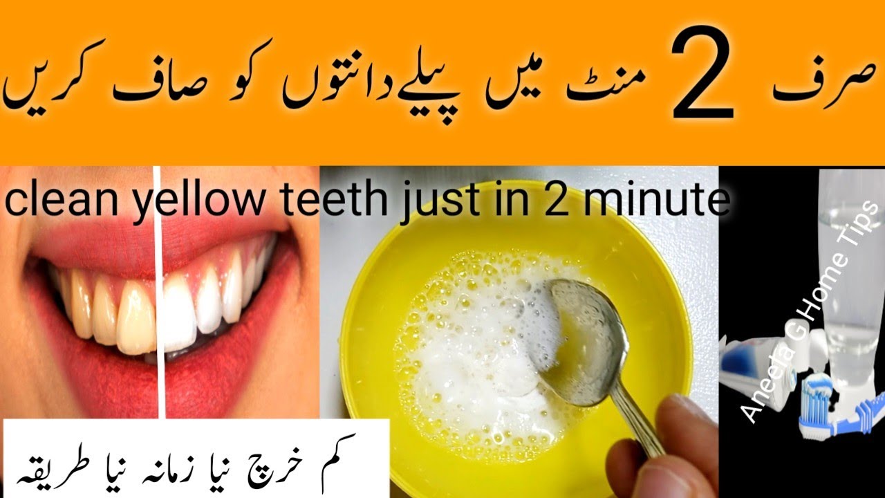 Danto Ko Saaf Karne Ka Tarika How To Clean Yellow Teeth Just In 2 Danto Ko Saaf Karne Ka Tarika How To Clean Yellow Teeth Just In 2