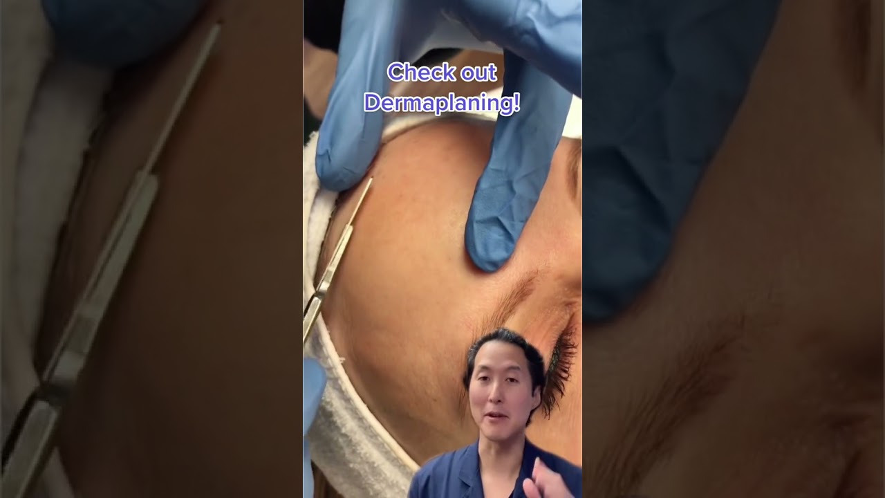 Check out Dermaplaning! 