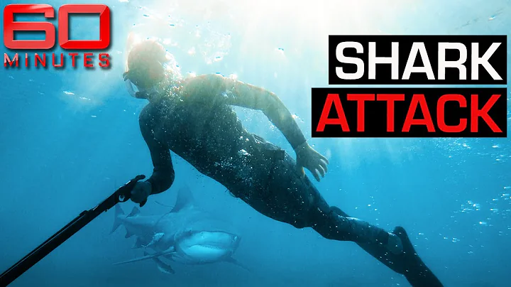 Young man attacked by a shark three times loses his leg | 60 Minutes Australia
