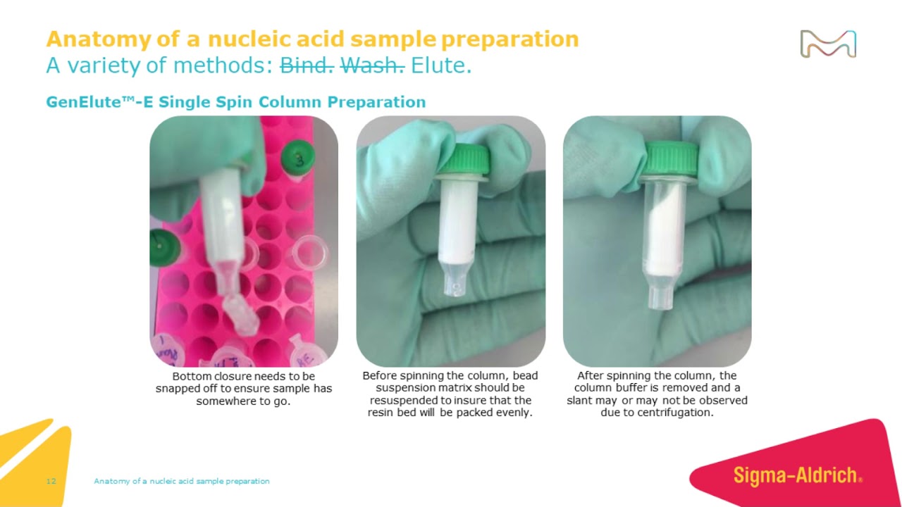 Anatomy of a nucleic acid sample preparation