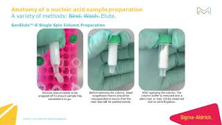 Anatomy of a nucleic acid sample preparation