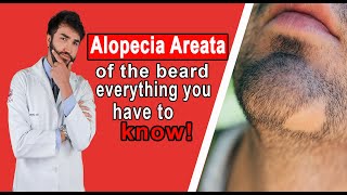 Alopecia Areata of the Beard everything you have to know