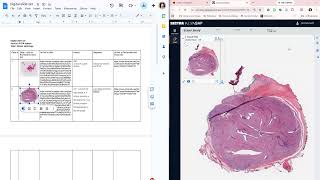 How to make and share a digital slide set with RCPA ecases
