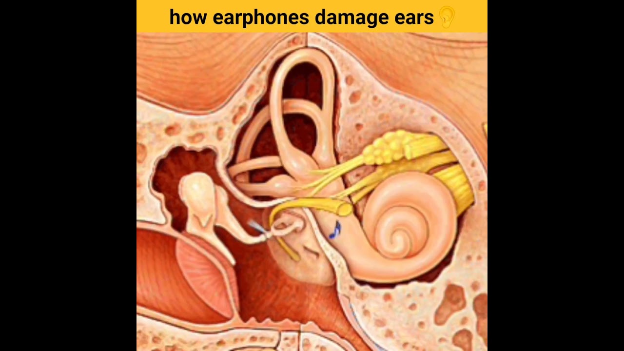 earphone lagane se kya hota hai 