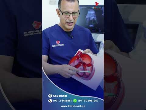 أمراض القلب الشائعة عند الأطفال فتحة ما بين البطينين مع د محمد سليمان 