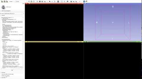 Texts - New module in 3D Slicer
