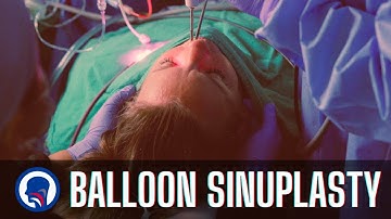 Ballon Sinuplastie Procedure | Capital ENT & Sinus Center
