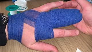 Finger Verbinden Nach Verstauchung Distorsion Finger Luxation Behandeln Und Schienen Anleitung Youtube