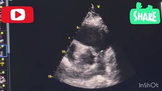 Vlog 8. Echo images in detail.