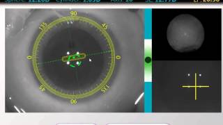 ORA System by WaveTec Vision - with VerifEye System