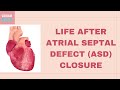 Life after Atrial Septal Defect Closure
