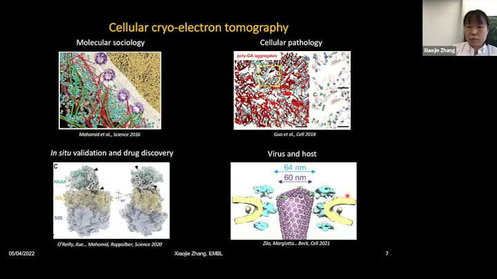 Xiaojie Zhang: "Expect the unexpected in cellular cryo-electron tomography: the story of our..."