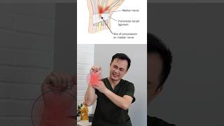 Numbness Of Han Wrist Tendinitis. Do This Exercise With Your Doctor
