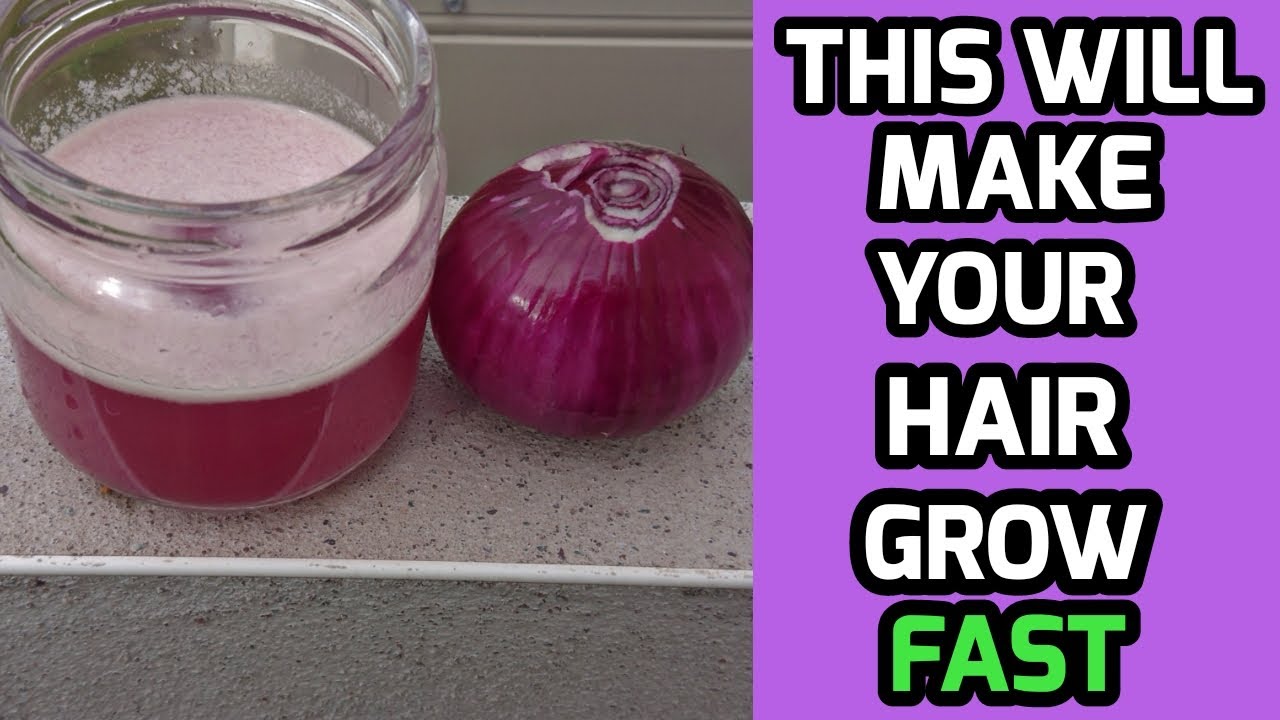 Right Way To Use Onion Juice For Hair Regrowth/Dandruff/ Hair fall