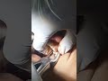 Orthodontic Extraction of upper first molar #youtubeshorts #dental #dentist #shorts #ytshort #viral