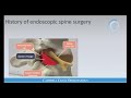 Endoscopic Spine Surgery - Why Bother Featuring Dr. Raymond Gardocki Campbell Clinic Orthopedics