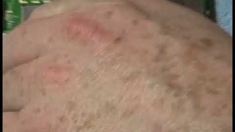 How to Replace Your Amazon Kindle 3 Battery