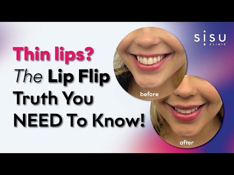 Everything You Need To Know About A Lip Flip