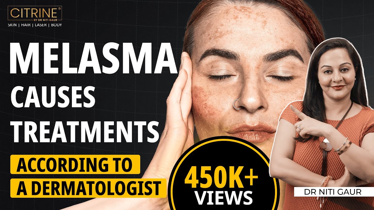 Melasma: Causes & Treatments | How to Remove Dark Spots on Face | Dr Niti Gaur | Citrine Clinic