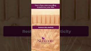 Microneedling Explained | Best Skin Care Clinic in Hyderabad | SkinLoom #skincare #trendingnow