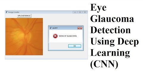 EYE GLAUCOMA DETECTION USING DEEP LEARNING