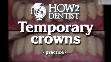 How to make temporary crowns. Part 3 - Practice / How to Dentist