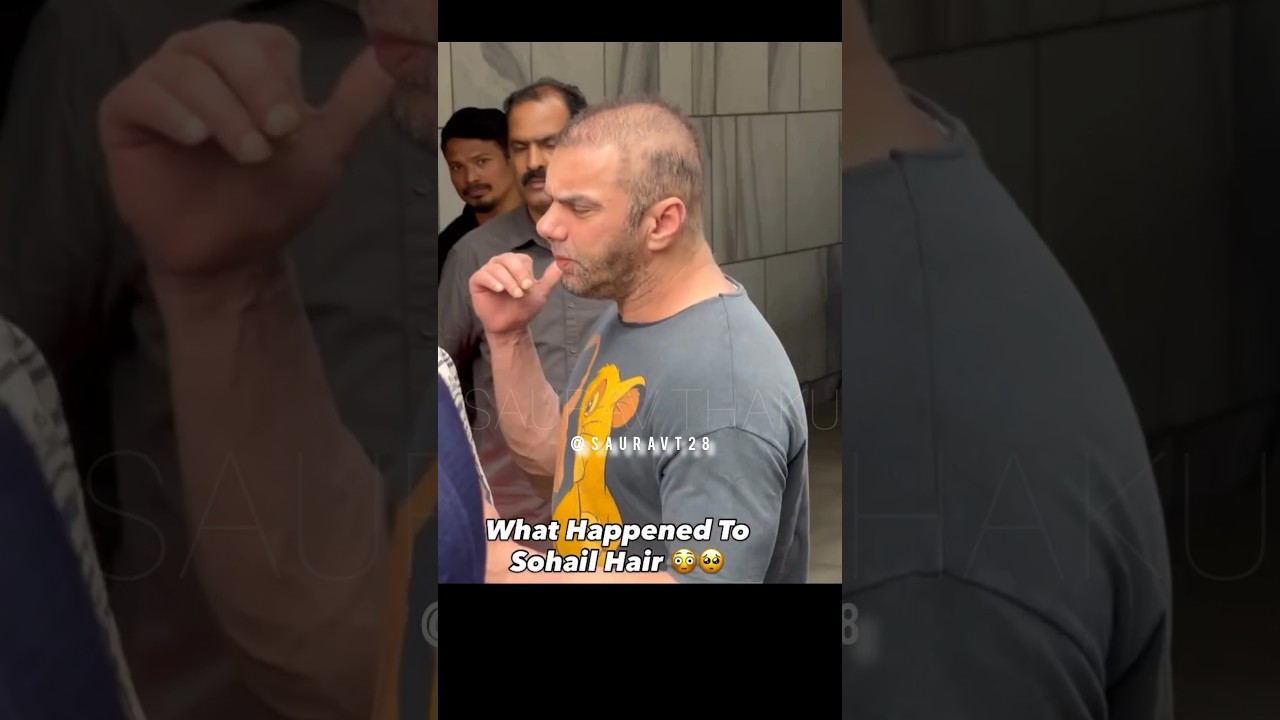 Is this due to age Or are these side effects of steroids?😮|| 