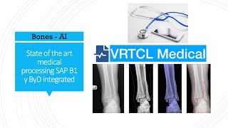 SAP - VRTCL Medical - Bones AI Integration, XRAY image processing ease diagnosis screenshot 3